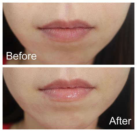 before and after dior addict lip maximizer plumping gloss|Dior lip maximiser boots.